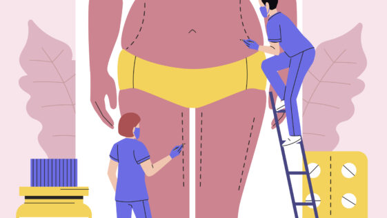 Weight Loss
